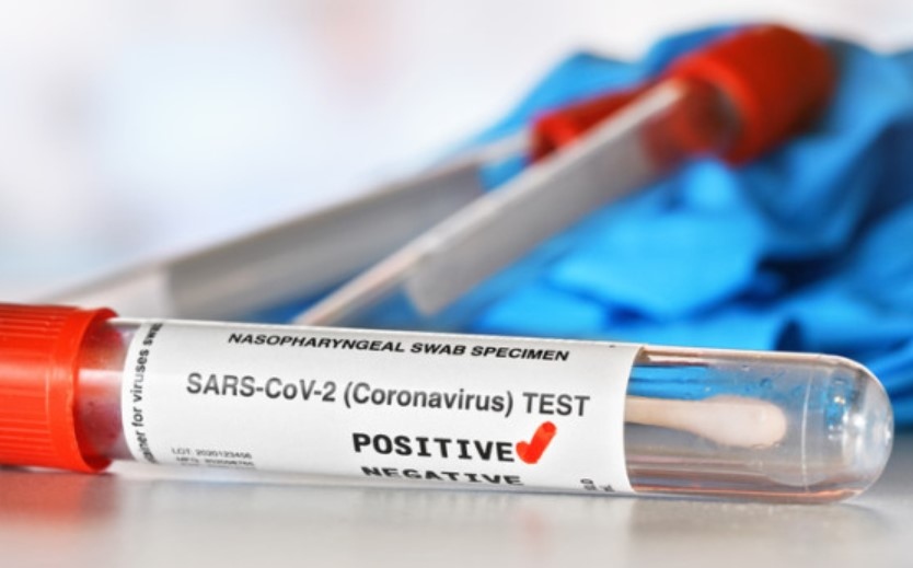 1610 са новите случаи на коронавирус у нас при направени